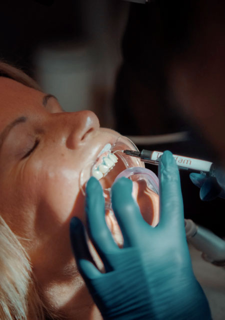 Diş beyazlatma işlemi öncesi hazırlık