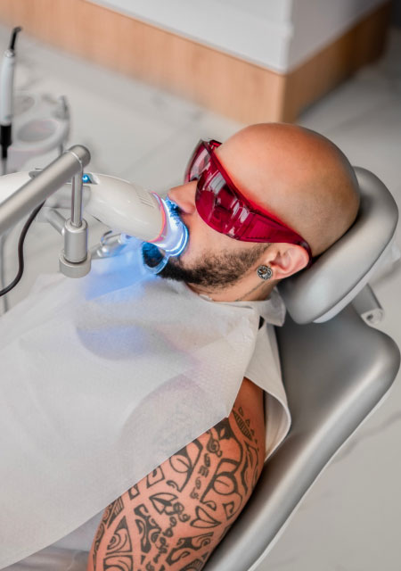 Diş beyazlatma işleminin faydaları nelerdir