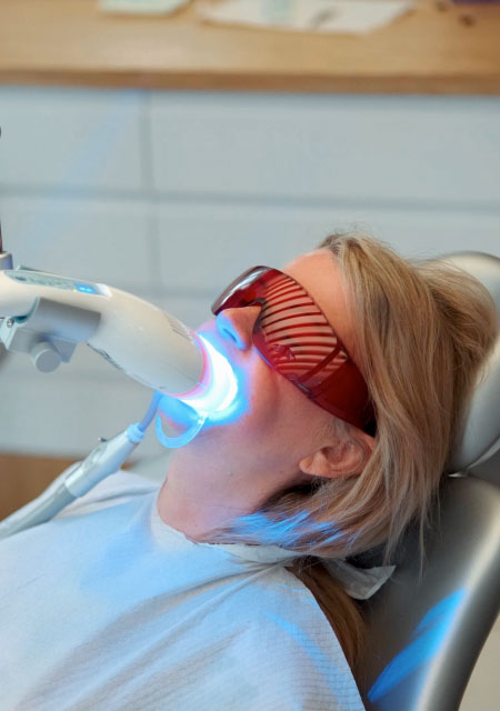 Hollywood Smile’ın faydaları